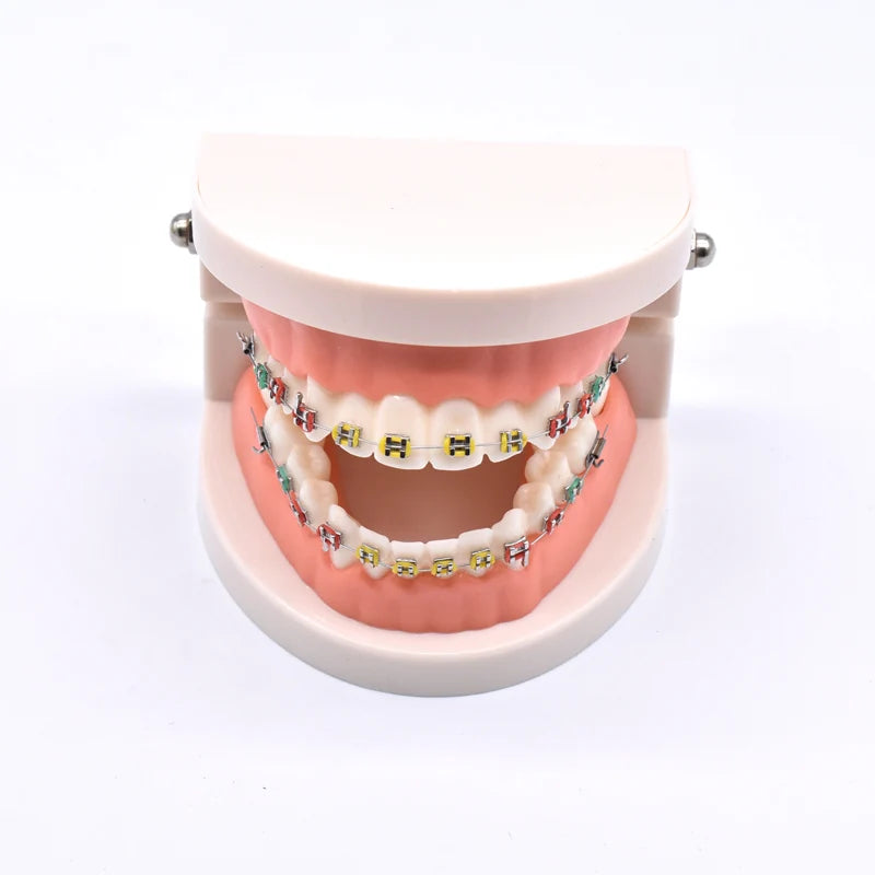 Dental Orthodontic Treatment Model With Ortho Metal Ceramic Bracket Arch Wire Buccal Tube Ligature Ties