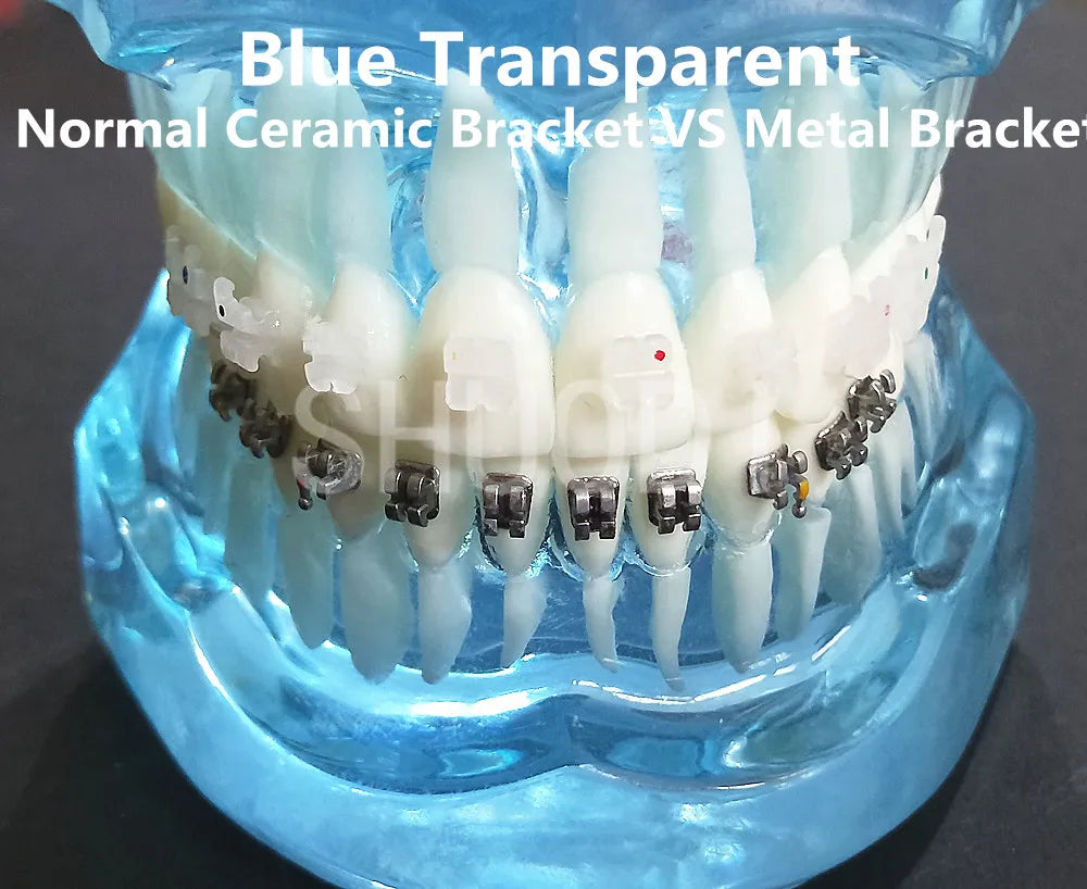 Dental Oral Care Tooth Teeth Model Dental Orthodontic Model for Patient Communication Dentist Study Model