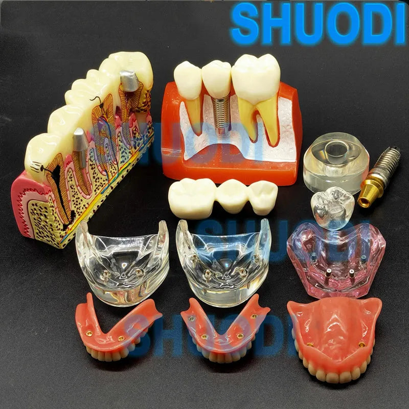 1 piece Dental Implant Demonstration Model Teeth Study Teach Model Communication Dental Overdenture Interior Mandibular Model
