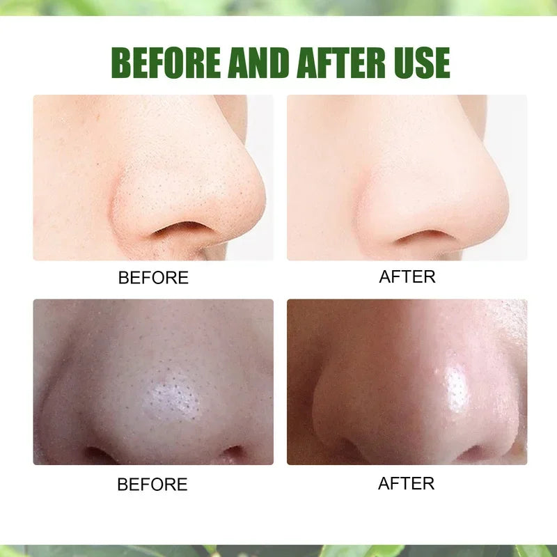 Pore Shrink Face Serum Green Tea Oil Control Remove Dark Spots Improve Acne Blackheads Dry Skin Firm Care Korean Cosmetics 10ml
