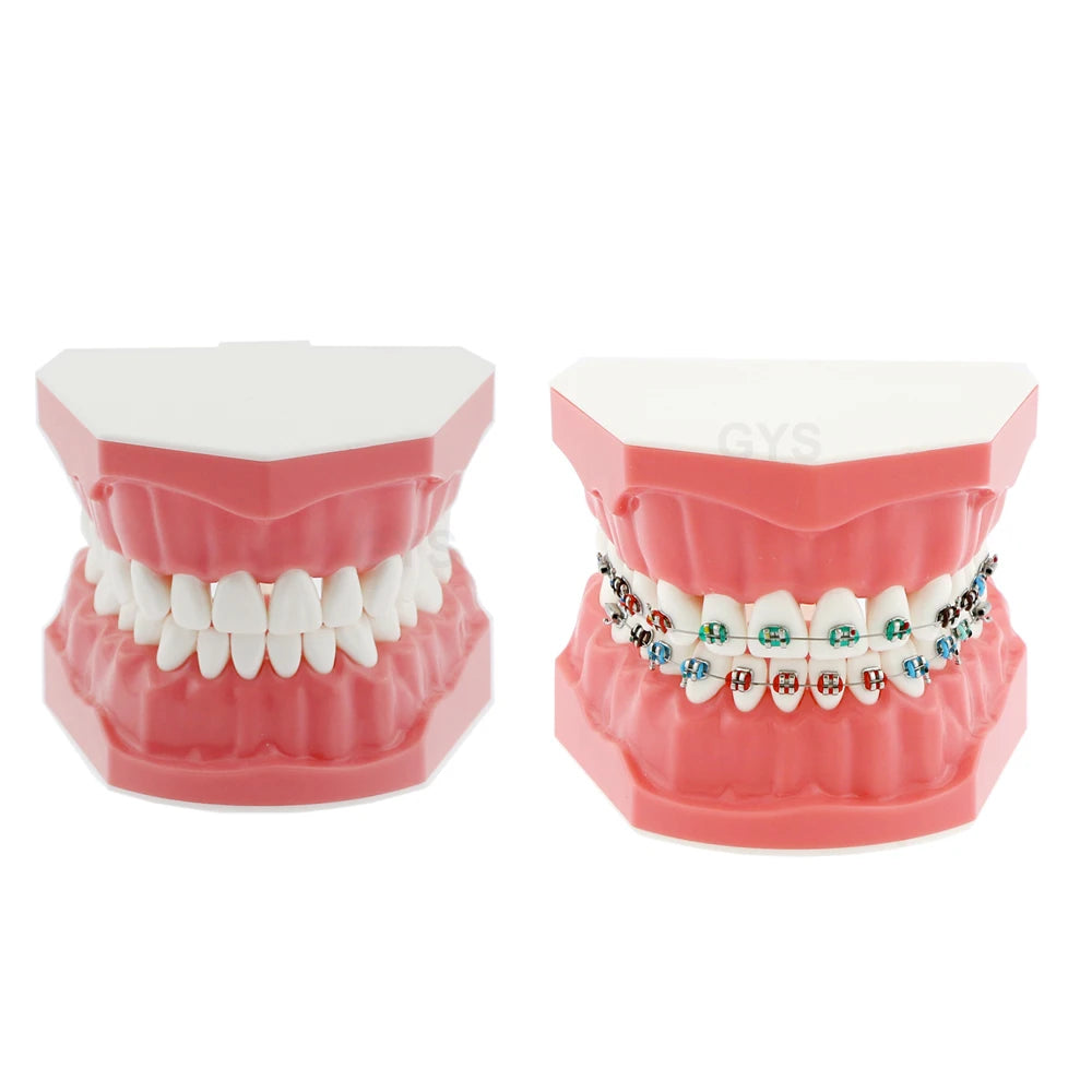 Dental Teaching Model Dentistry Orthodontic Teeth Model With Brackets For Dentist Studying Patient Demo Dentist Material