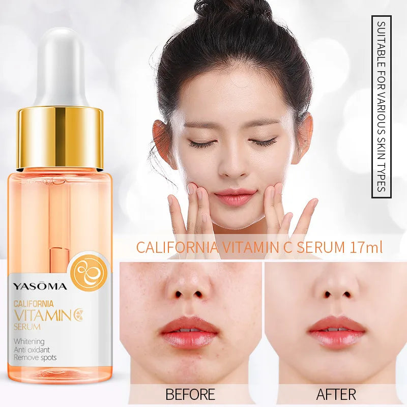 YASOMA Vitamin C Face Serum Brightening Whitening Hydration Anti-Wrinkle Anti-aging Serum Facial Essence Beauty Health Skin Care