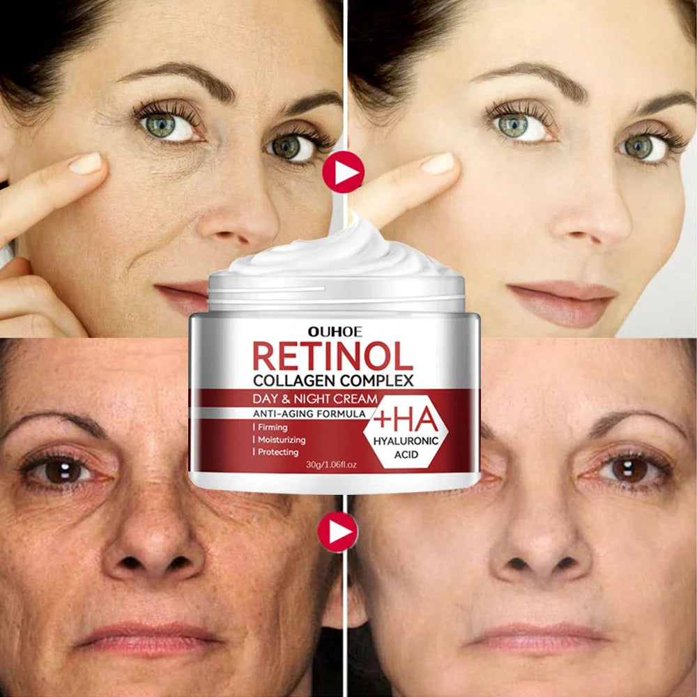 Retinol Remove Wrinkles Face Cream Lifting Firming Anti-Aging Fades Fine Lines Moisturizing Brighten Skin Care Korean Cosmetics