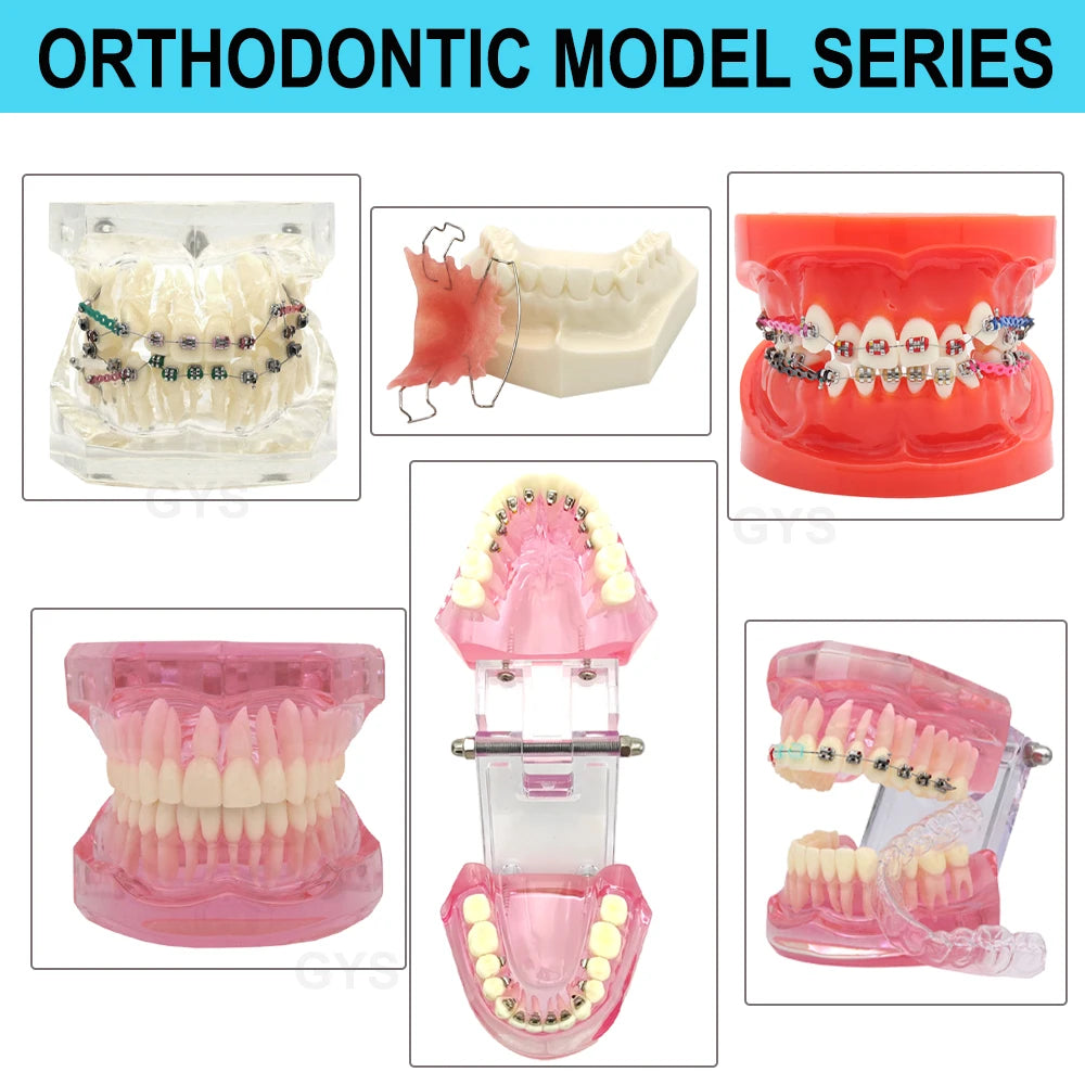 Dental Model Teeth Dental Teaching Models Implant Model Study Orthodontic Removable Teeth High Quality Dentist Material