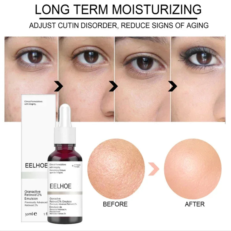 Salicylic Acid Pore Shrink Face Serum Hyaluronic Acid Moisturizing Nourish Smooth Pores Repair Essence Firm Skin Korean Cosmetic