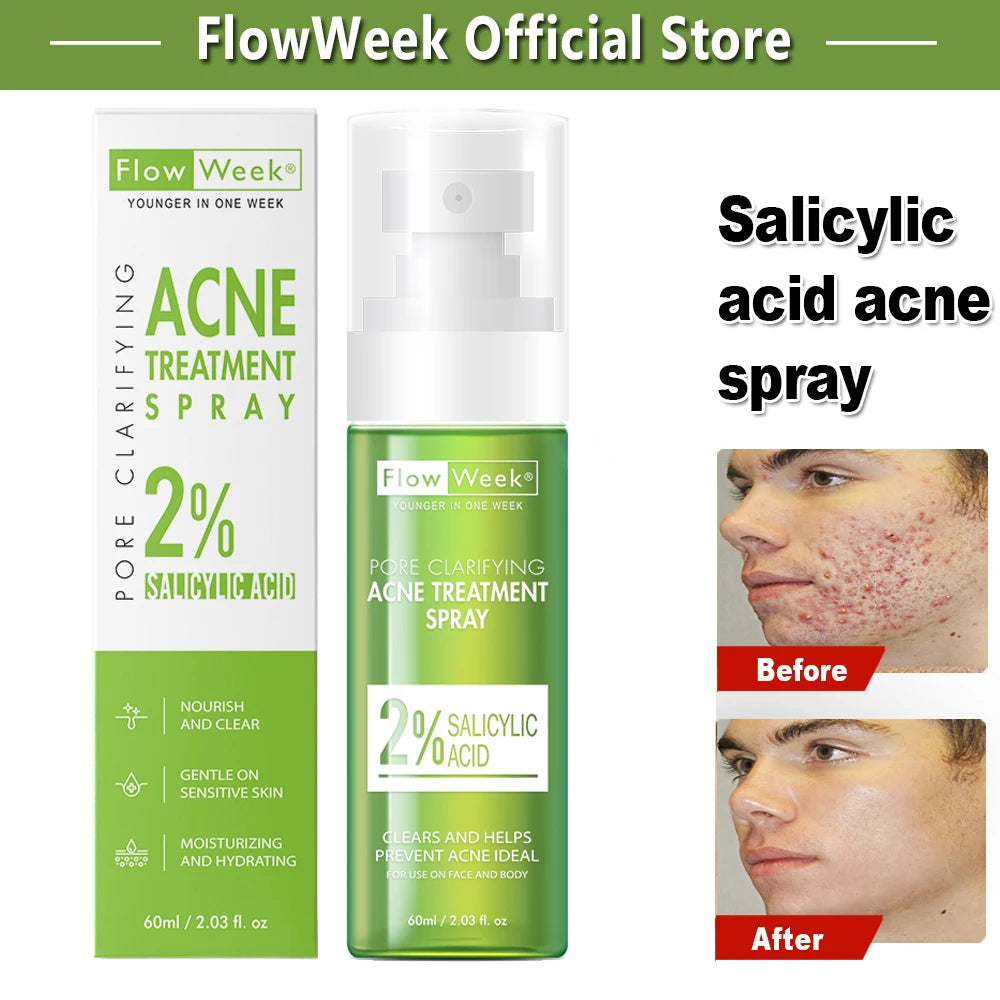 FlowWeek 60ml Salicylic Acid Anti-Acne Spray Remove Blackhead Pimple Acne Scar Treatment Cream Shrink Pore Moisturizing Skincare