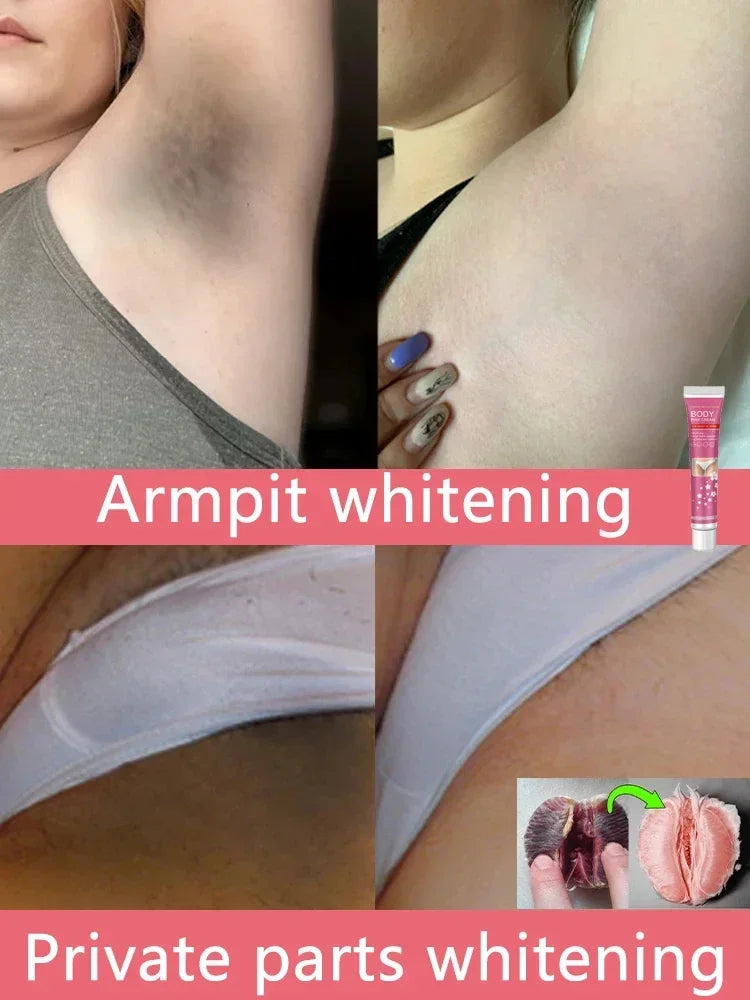 Whitening Cream Private Parts Underarm Bleaching Serum Whiten Butt Knee Brighten Inner Thigh Intimate Parts Dark Remove Melanin
