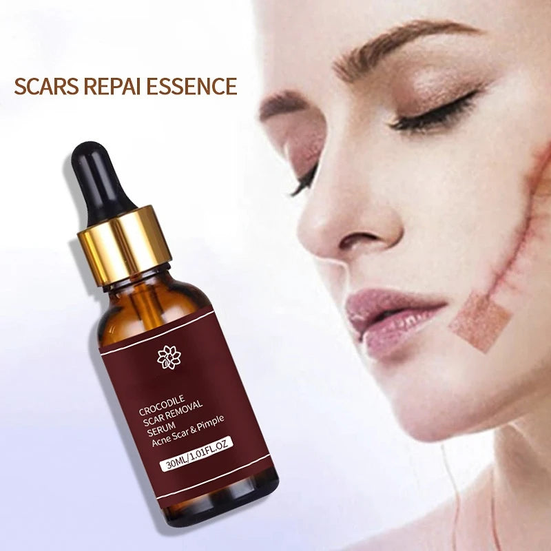 Moisturizing Repair Skin Whiten Anti-Aging Anti-wrinkle Deep SkinCare Essence Acne Scar Removal vitamin c serum Face Serum