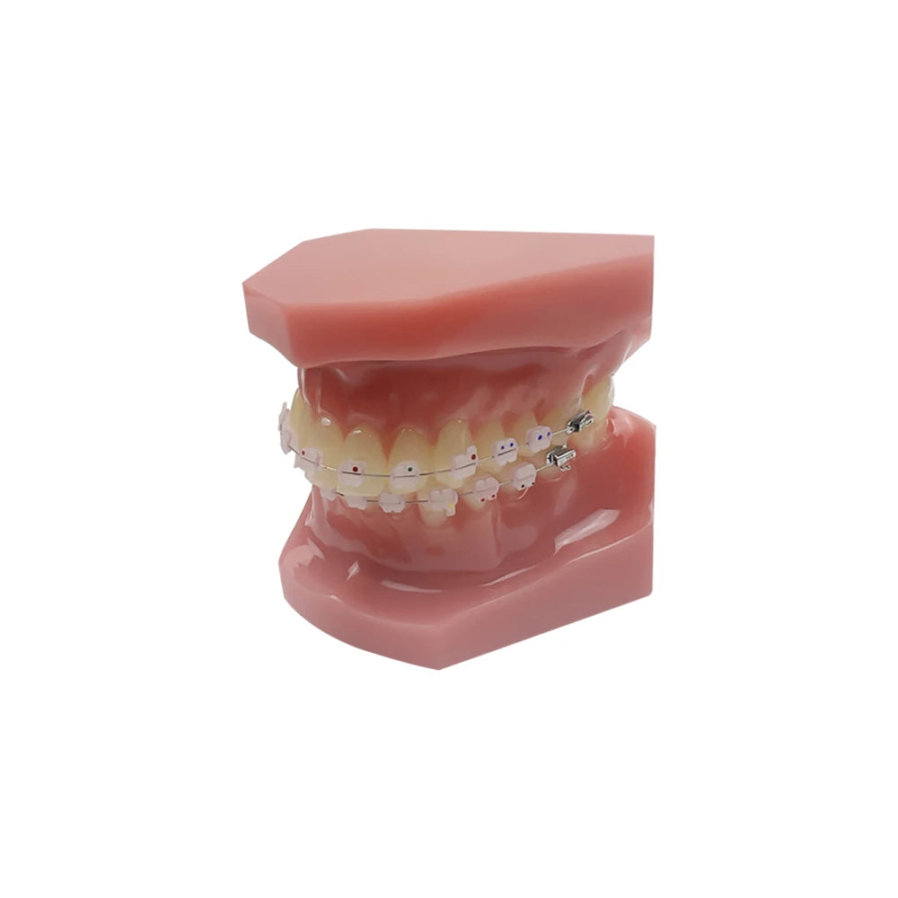 Dental Orthodontic Teeth Teaching Model for Dental Technician Practice Training Studying Orthodontic Model