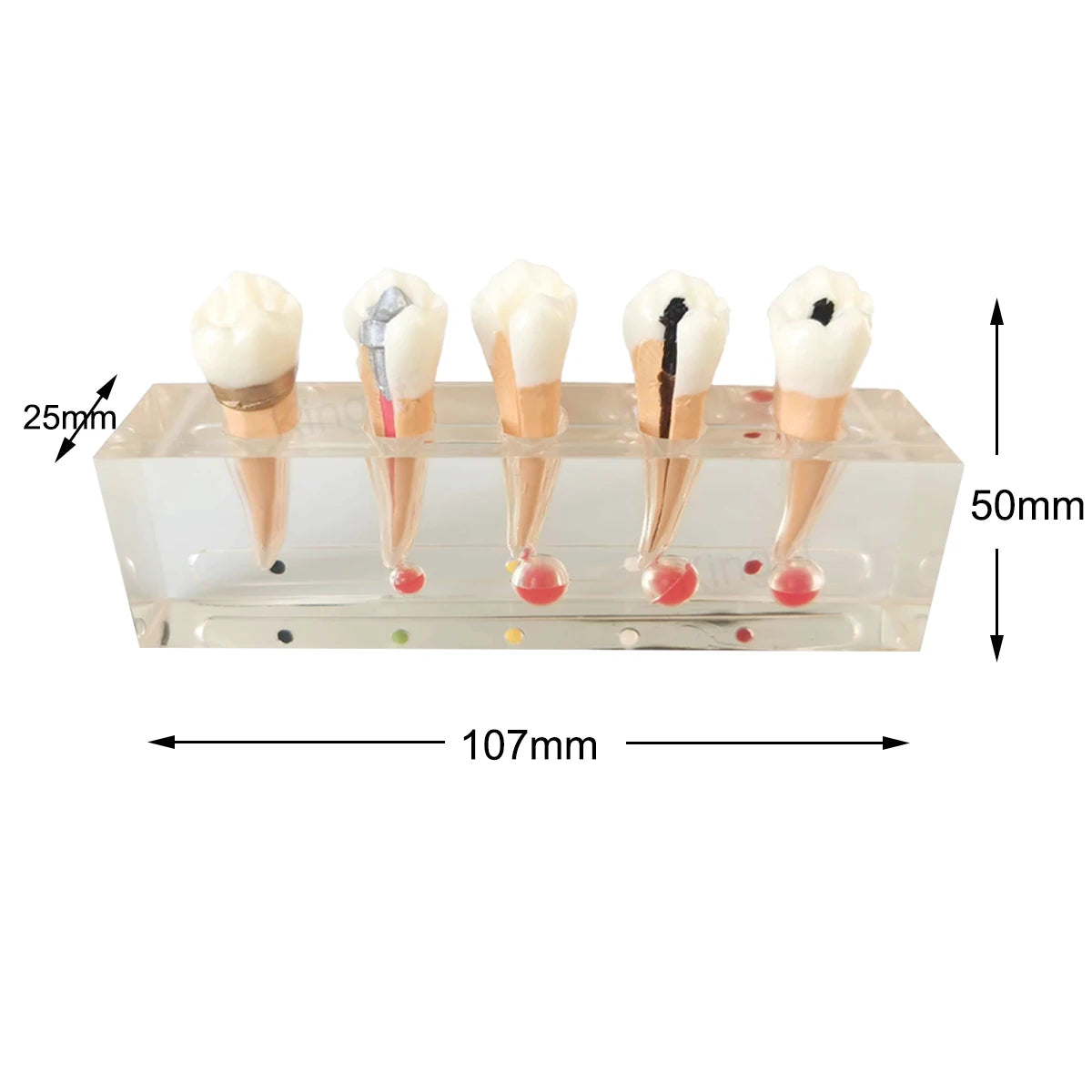 Dental Teaching Model Endodontic Treatment Model Demos 5 Stages of Root Canal Procedure on 2nd Premolar for Dental Laboratory