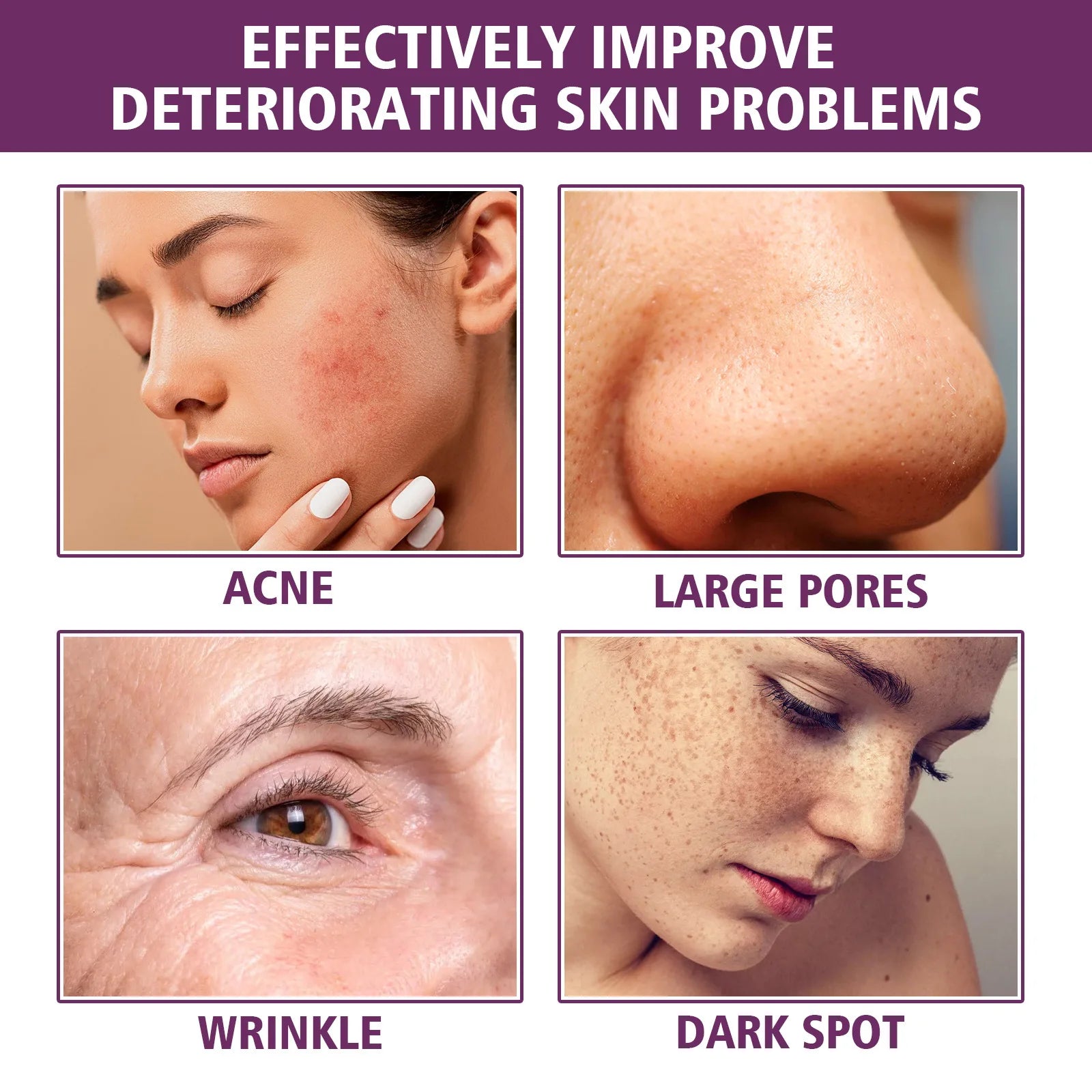 Niacinamide Face Serum Face Pigment Dark Spot Remover Purify Acne Marks Reduce Fine Lines Enhance Elasticity Restoring Essence