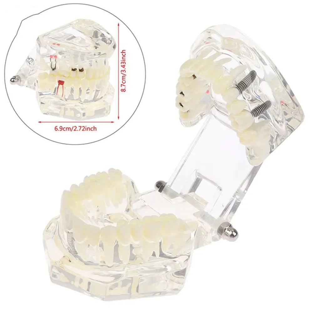 Dental Models Removable And Restorable Models Of Diseased Teeth For Teaching And Researching Medical And Dental Diseases