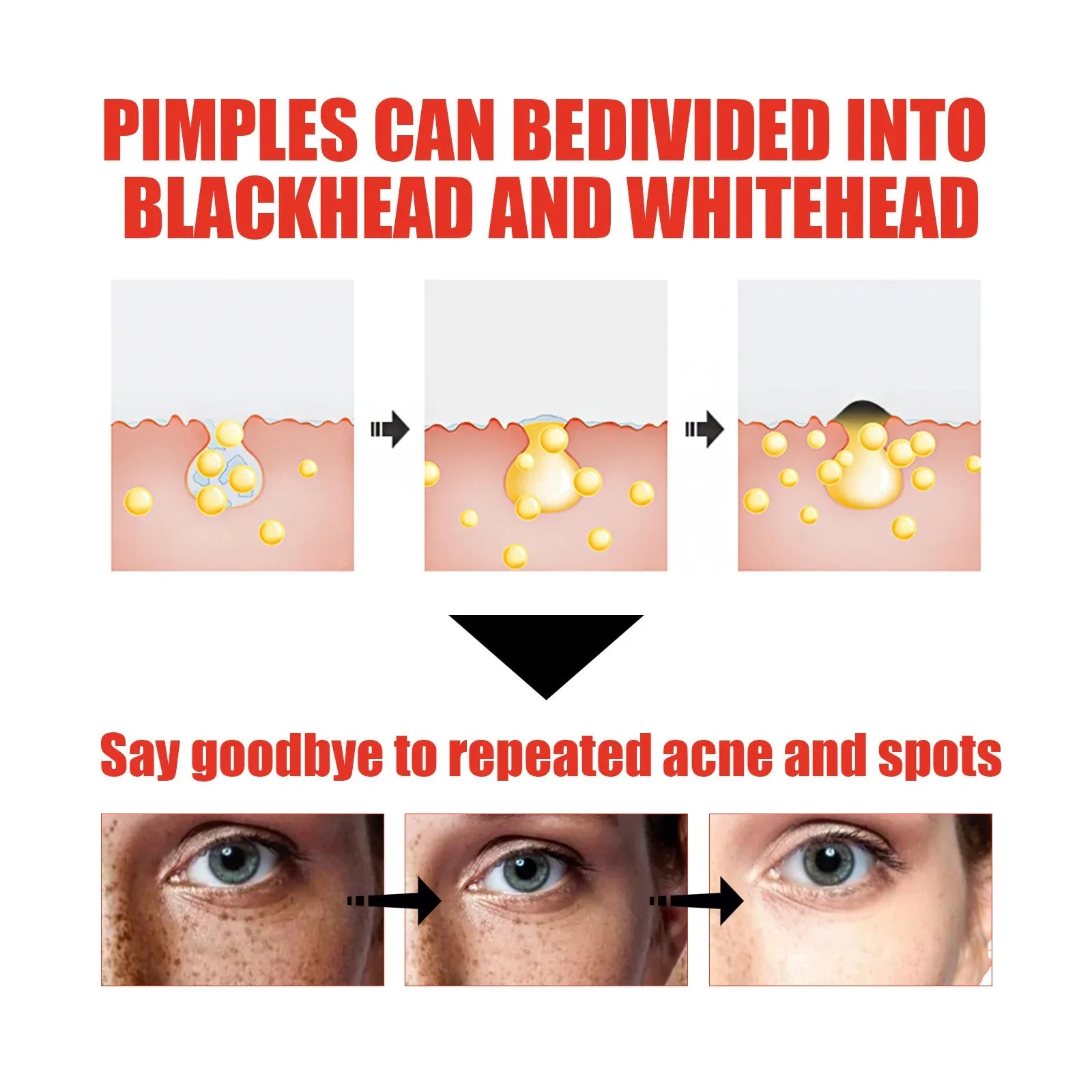 Niacinamida Whitening Face Serum Freckles Dark Spot Remover Salicylic Acid Pore Shrink Moisturizing Korean Skin Care Product30ml