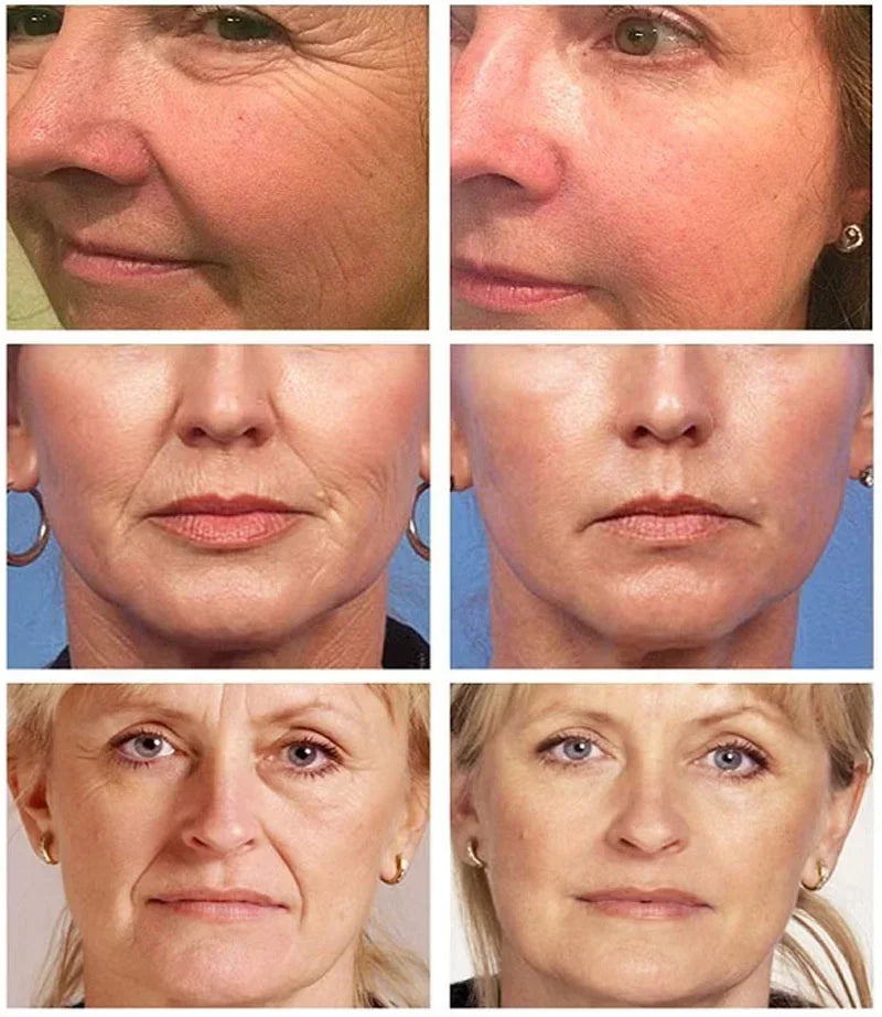 Retinol Face Cream Firming Lifting Anti-Aging Face Serum Reduce Wrinkle Fine Line Moisturizing Essence Brighten Repair Skin Care