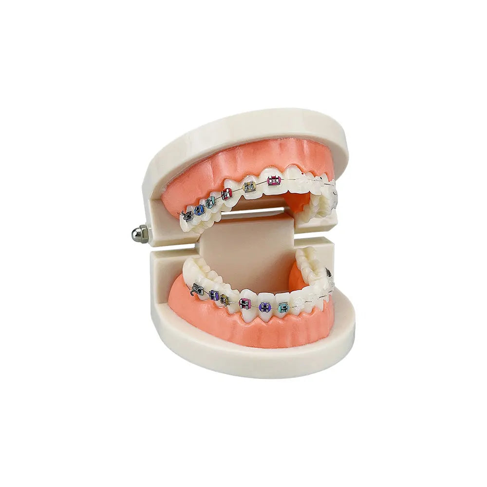 Dental Teaching Model Standard Dental Orthodontic Teeth Model With Braces Metal / Ceramic Brackets For Dentistry Education Study